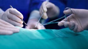 Hypospadias-Surgery